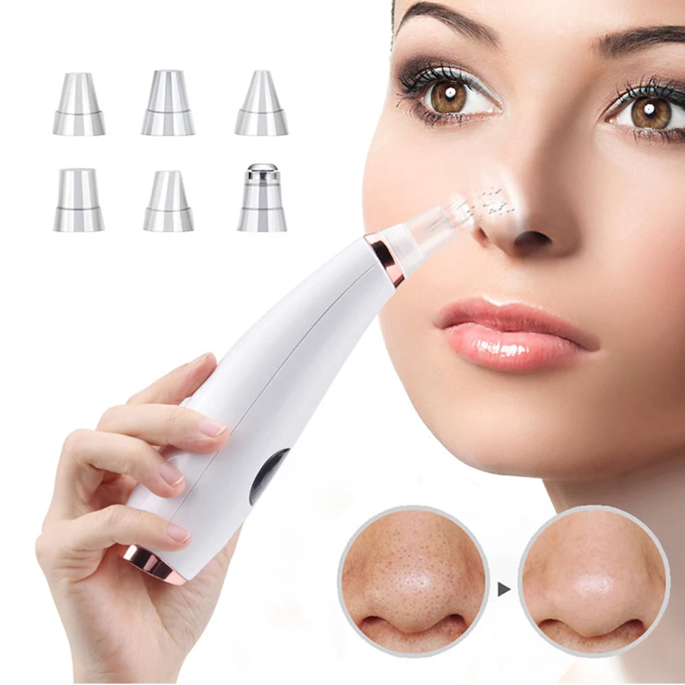 Auriéa Beauty Electric Blackhead Remover