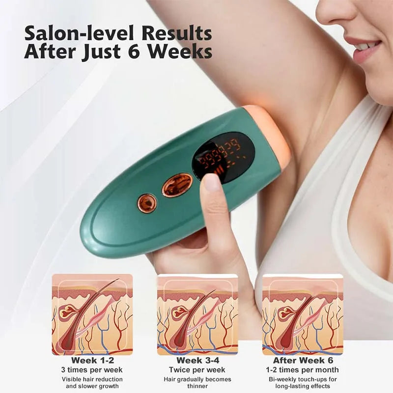 Aurièa IPL Laser Hair Removal Device