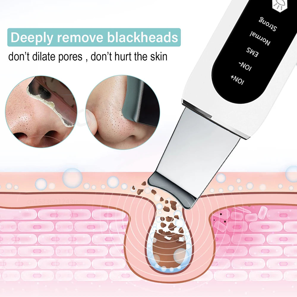 Auriéa Beauty Ultrasonic Skin Scrubber