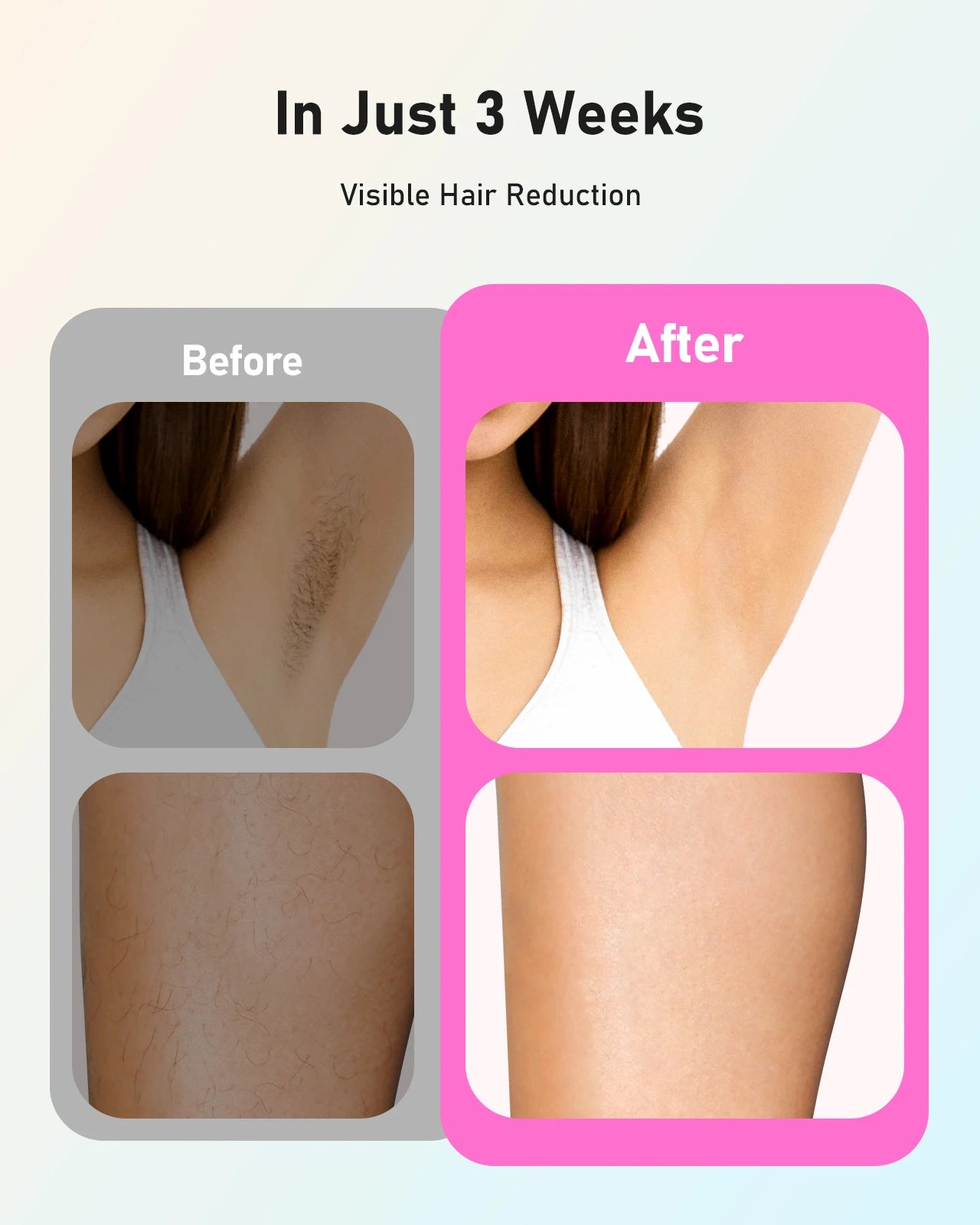 Auriéa Beauty Laser Hair Removal