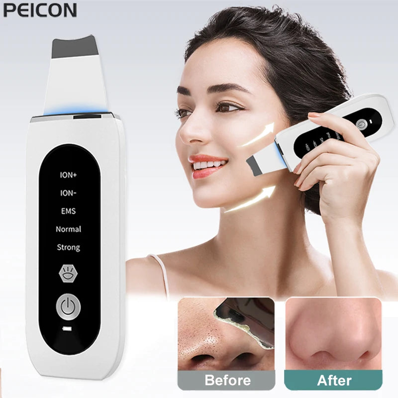 Auriéa Beauty Ultrasonic Skin Scrubber