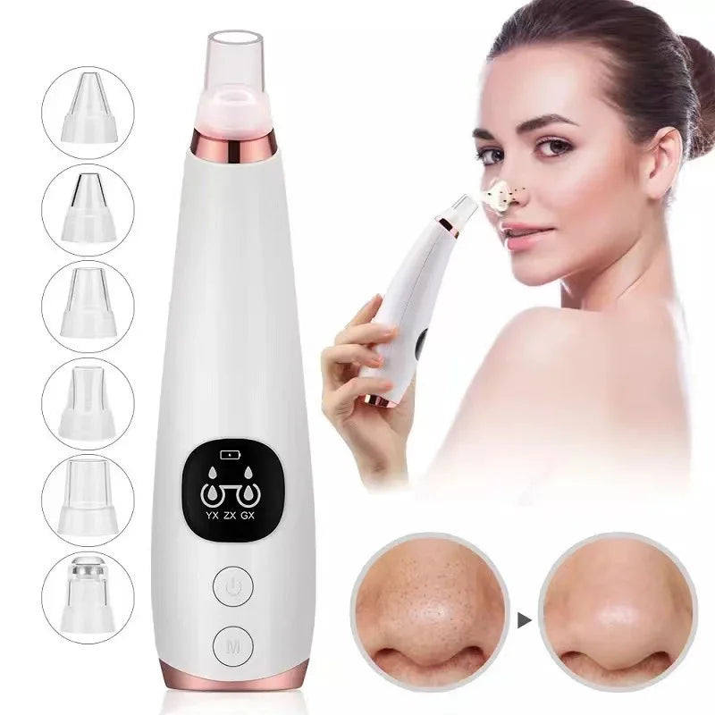 Auriéa Beauty Electric Blackhead Remover