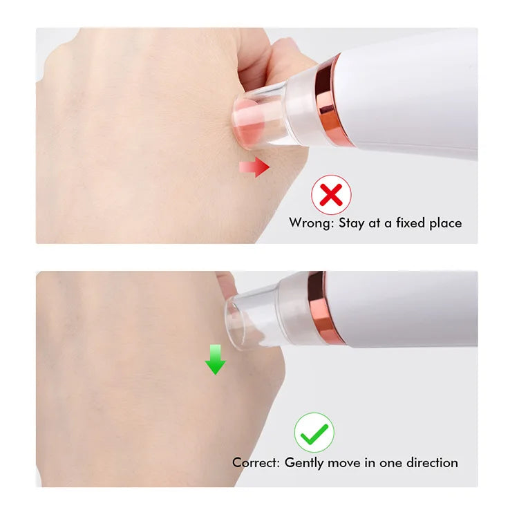 Auriéa Beauty Electric Blackhead Remover