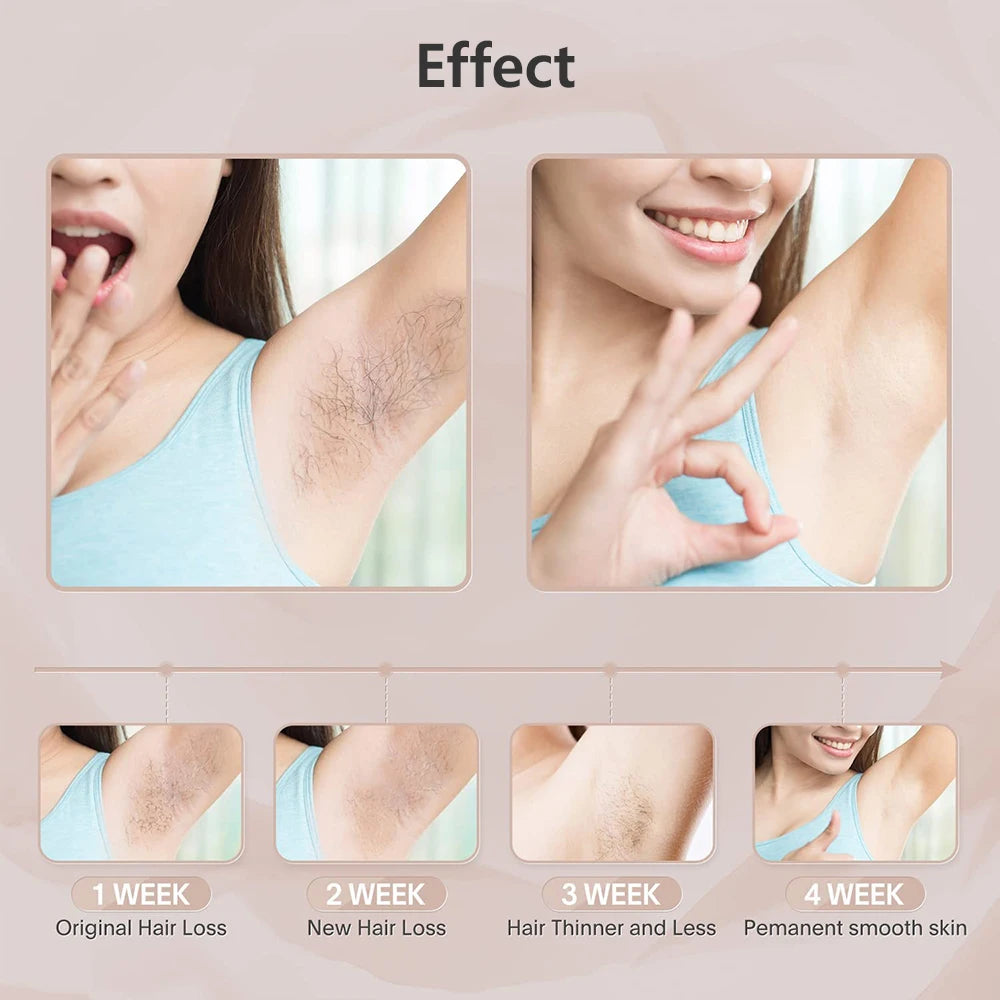 Auriéa Beauty IPL Laser Hair Remover
