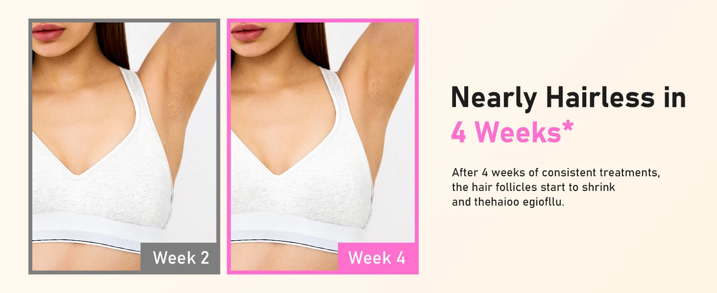Auriéa Beauty Laser Hair Removal