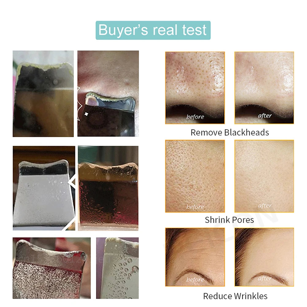 Auriéa Beauty Ultrasonic Skin Scrubber