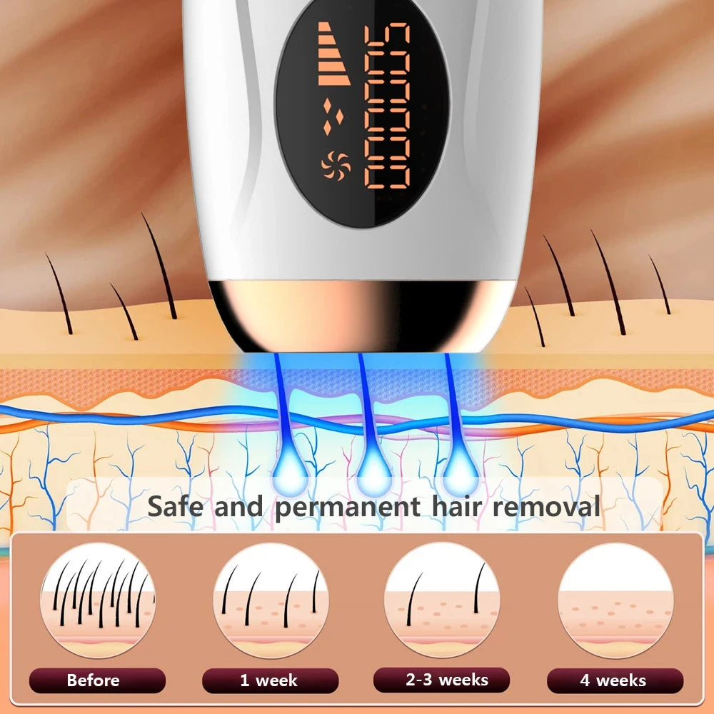 Auriéa Beauty IPL Laser Hair Remover