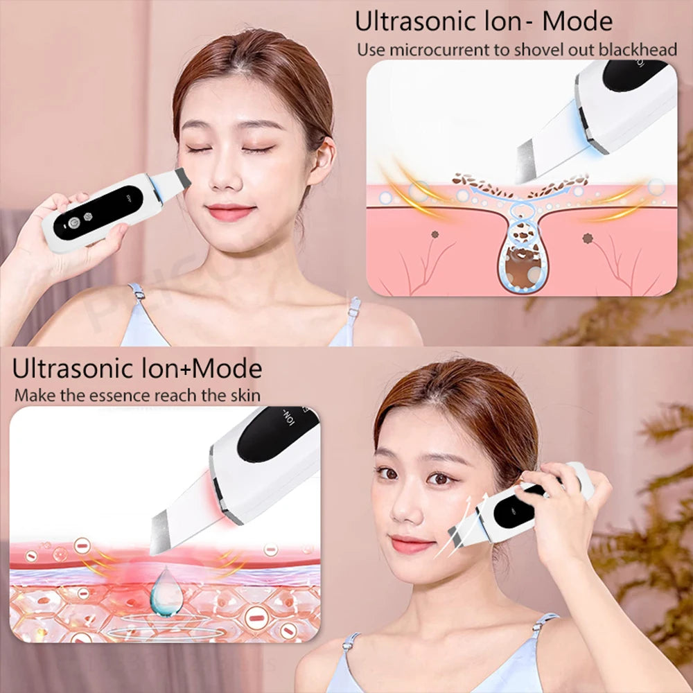 Auriéa Beauty Ultrasonic Skin Scrubber