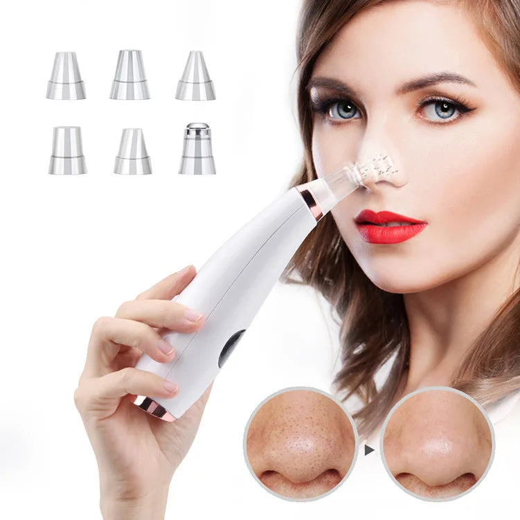 Auriéa Beauty Electric Blackhead Remover