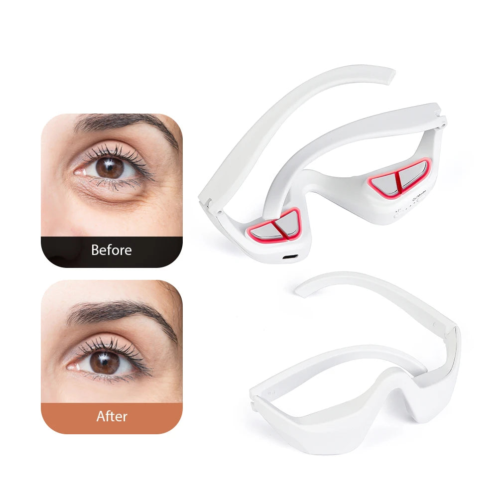 Auriéa Beauty 3D Eye Massager