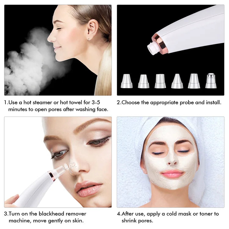 Auriéa Beauty Electric Blackhead Remover