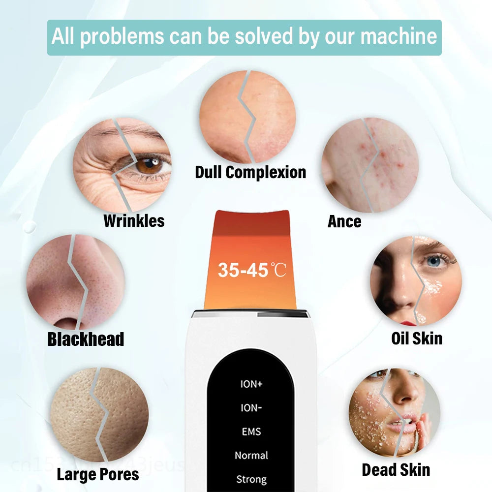Auriéa Beauty Ultrasonic Skin Scrubber