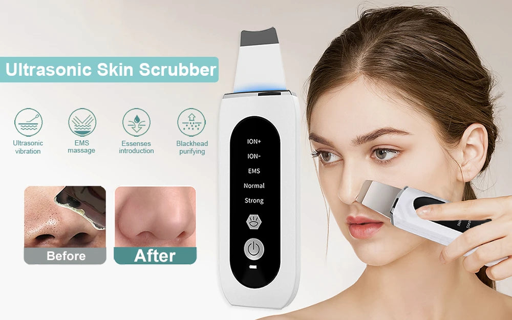 Auriéa Beauty Ultrasonic Skin Scrubber